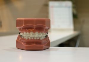 Affordable Braces for Adults in Woodbridge, NJ