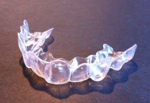 How to Clean Your Invisalign Retainer