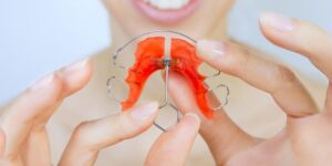 What is a Palate Expander? And Why Your Child Might Need One